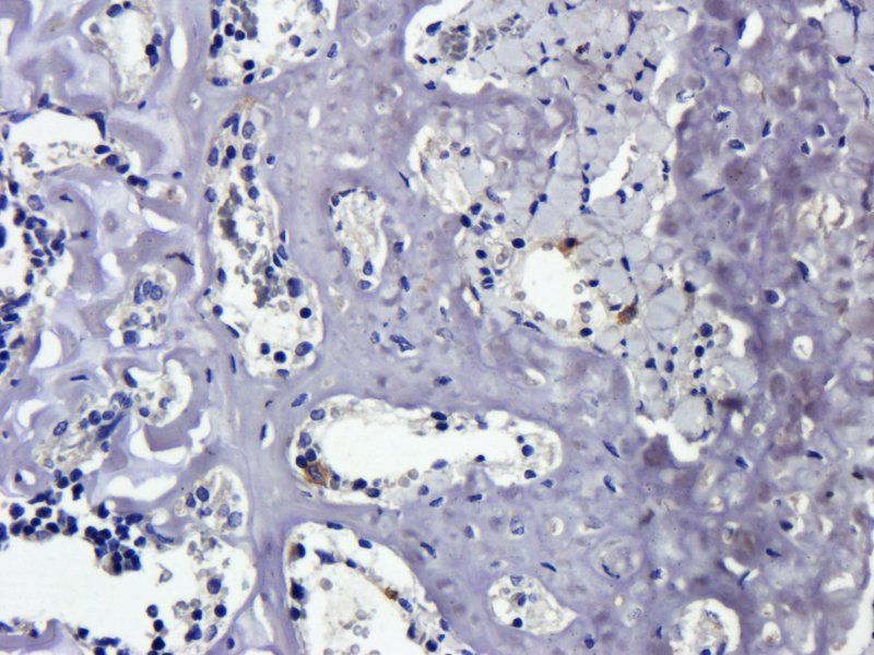 BCL2 Rabbit Polyclonal Antibody