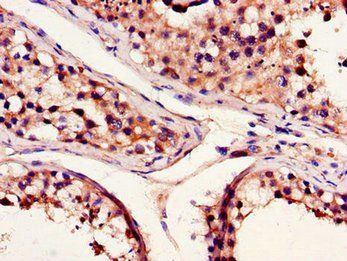 BCL2A1 Antibody