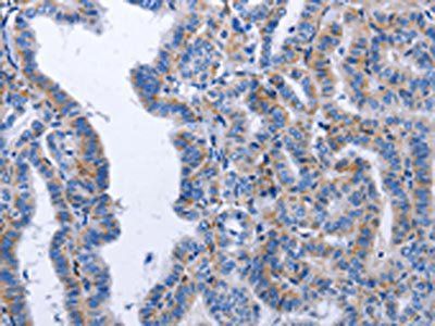 BDNF Antibody