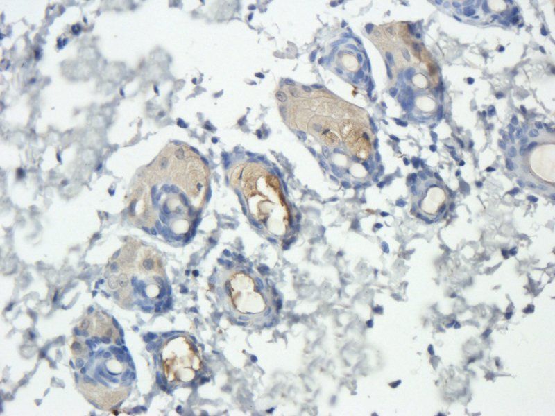 BDNF Rabbit Polyclonal Antibody