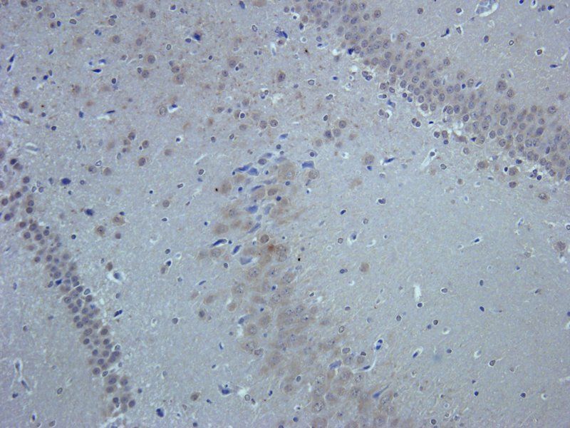 BDNF Rabbit Polyclonal Antibody
