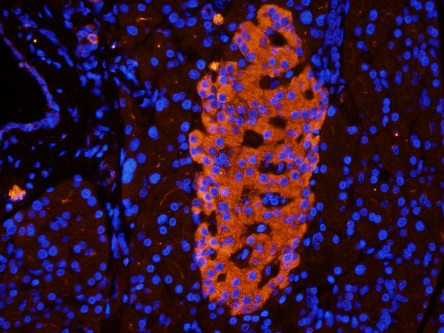 Beclin 1 Rabbit Polyclonal Antibody