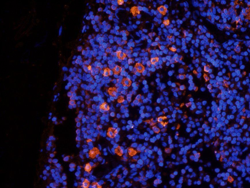 Beclin 1 Rabbit Polyclonal Antibody