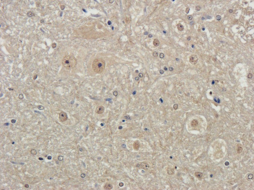 Beclin 1 Rabbit Polyclonal Antibody