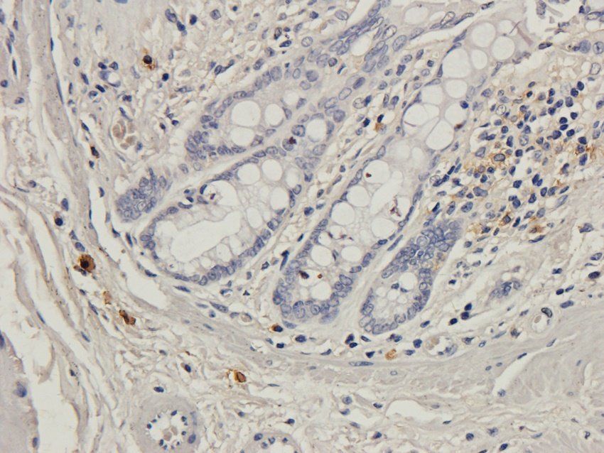 Beclin 1 Rabbit Polyclonal Antibody