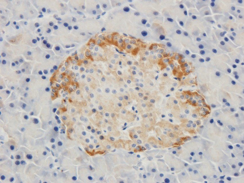 Beclin 1 Rabbit Polyclonal Antibody