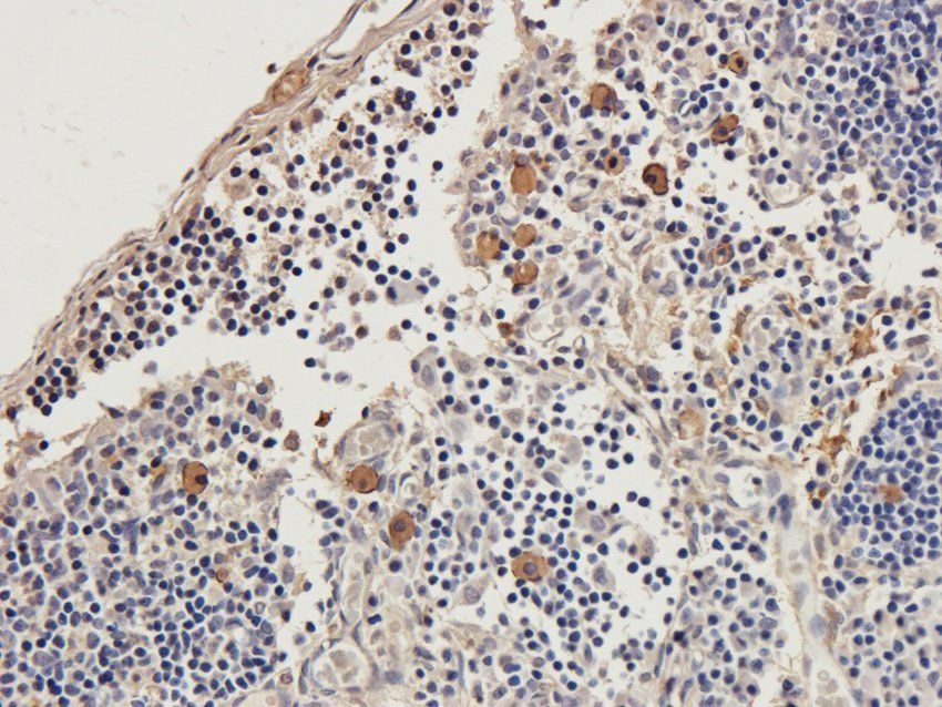 Beclin 1 Rabbit Polyclonal Antibody