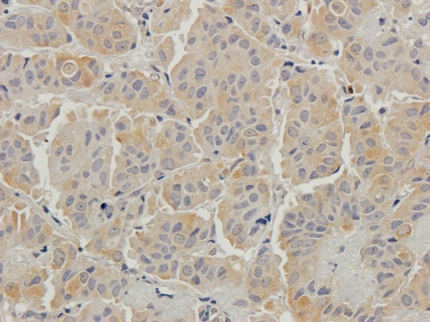 Beclin 1 Rabbit Polyclonal Antibody