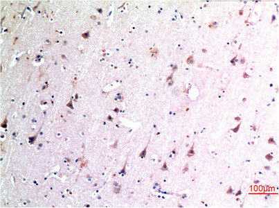 BECN1 Antibody