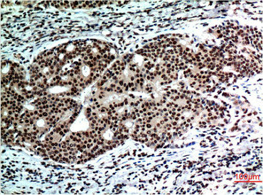 BECN1 Antibody