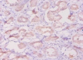 DEFB1 Antibody