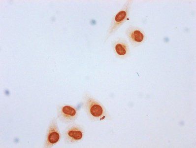 HIST1H3A Antibody
