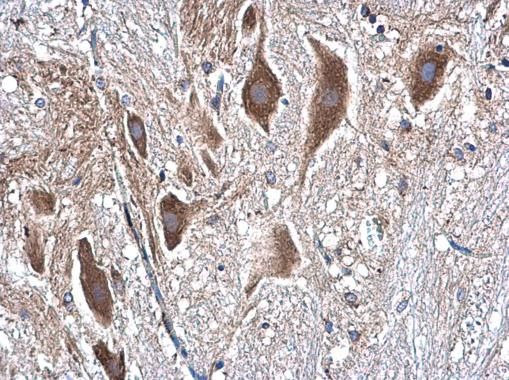 beta Tubulin Rabbit Polyclonal Antibody