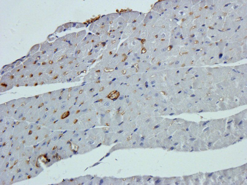 beta 1 Adrenergic Receptor Rabbit Polyclonal Antibody