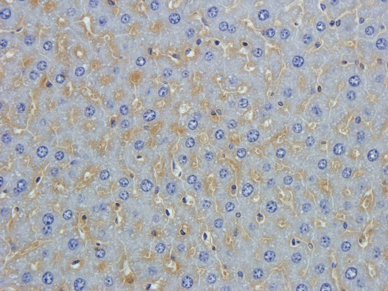 beta 1 Adrenergic Receptor Rabbit Polyclonal Antibody
