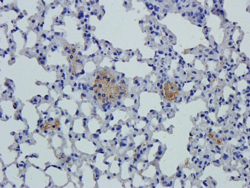 beta 1 Adrenergic Receptor Rabbit Polyclonal Antibody
