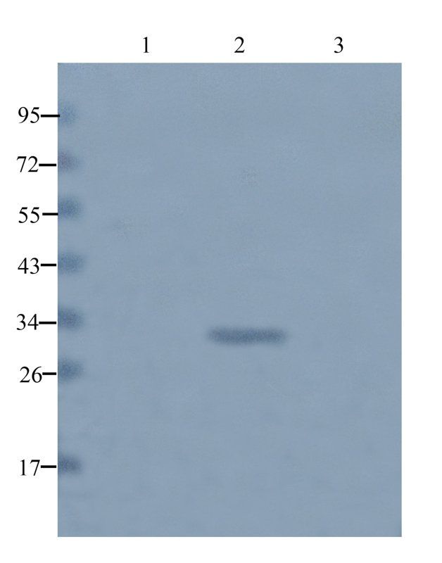 beta 1 Adrenergic Receptor Rabbit Polyclonal Antibody