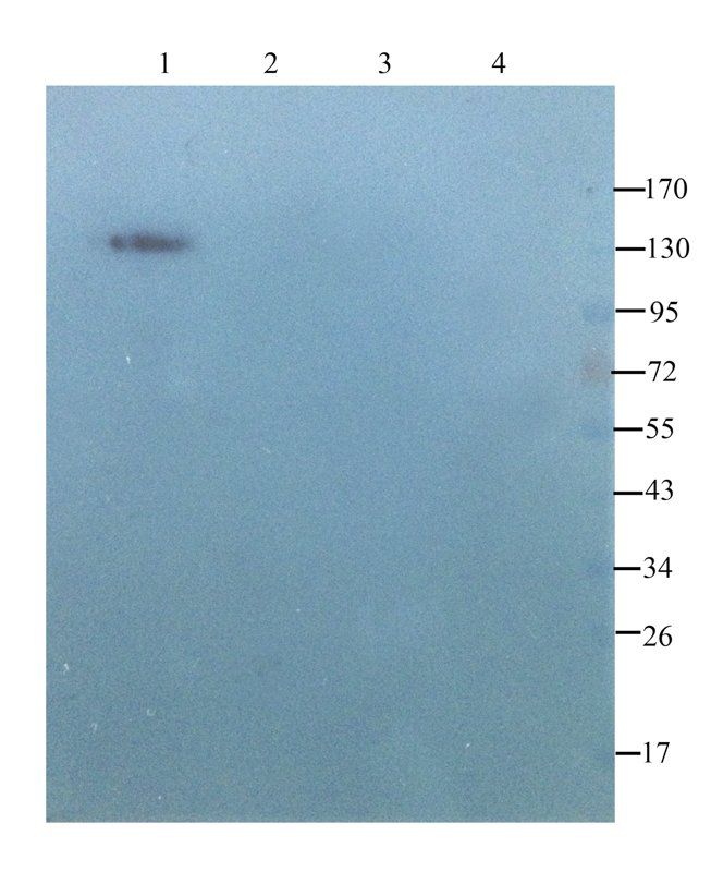 beta 1 Adrenergic Receptor Rabbit Polyclonal Antibody
