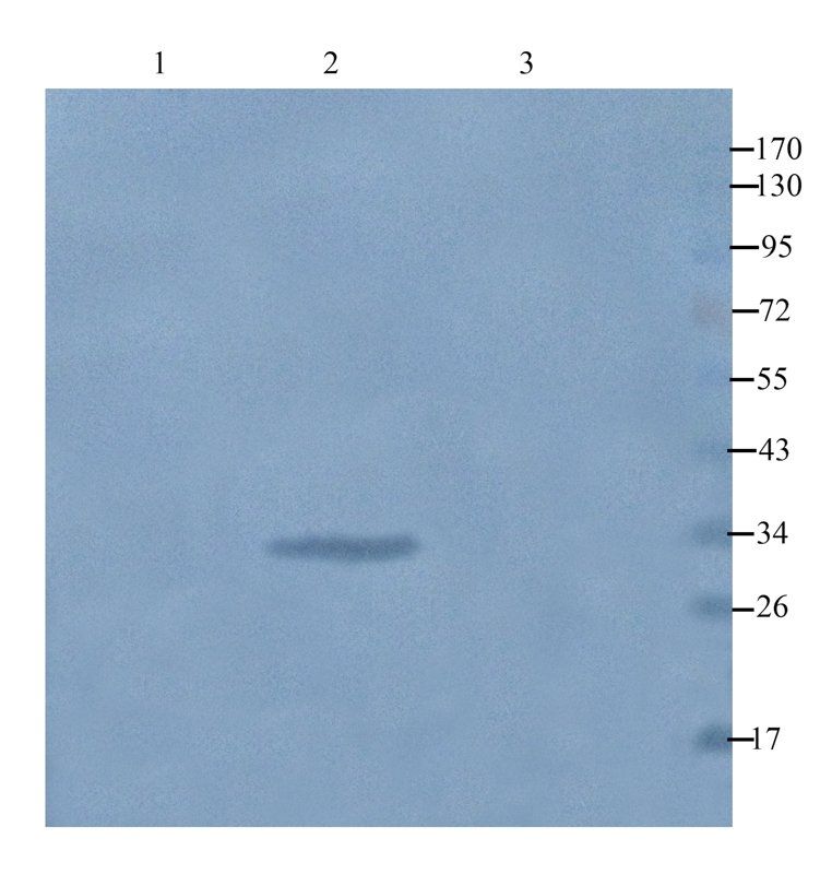 beta 1 Adrenergic Receptor Rabbit Polyclonal Antibody