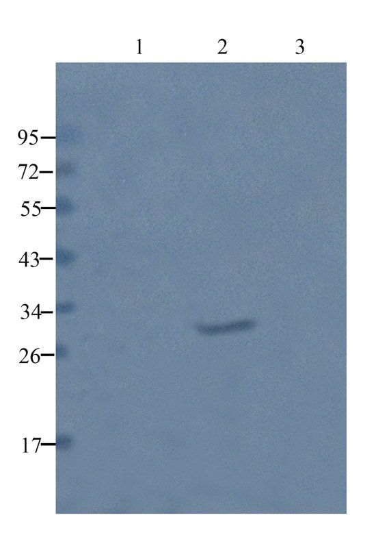 beta 1 Adrenergic Receptor Rabbit Polyclonal Antibody