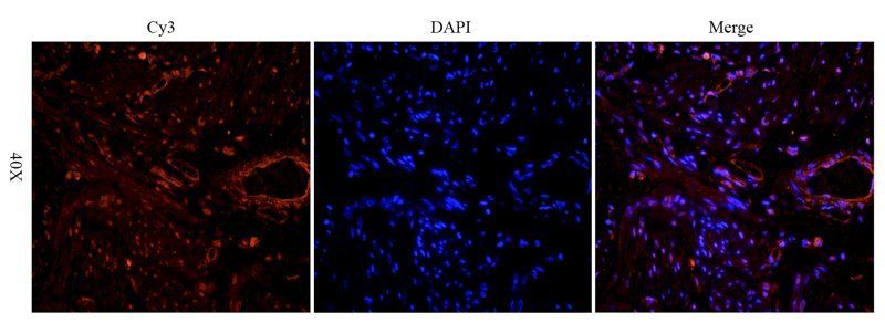 beta 1 Adrenergic Receptor Rabbit Polyclonal Antibody