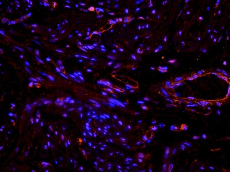 beta 1 Adrenergic Receptor Rabbit Polyclonal Antibody