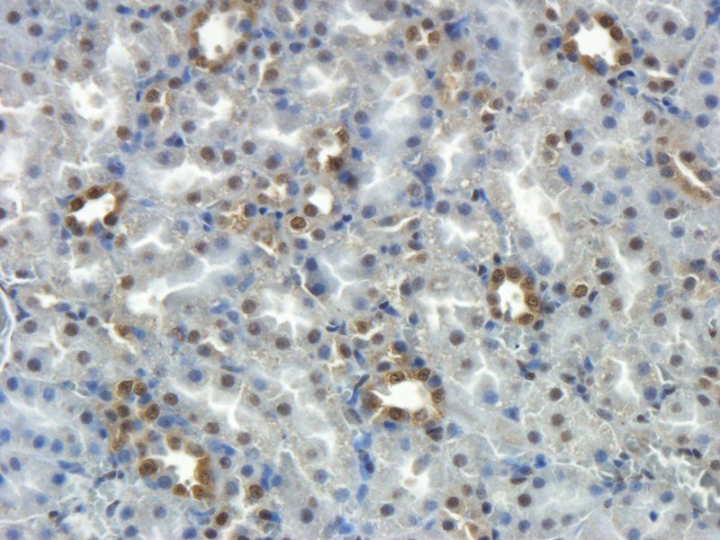 beta 1 Adrenergic Receptor Rabbit Polyclonal Antibody
