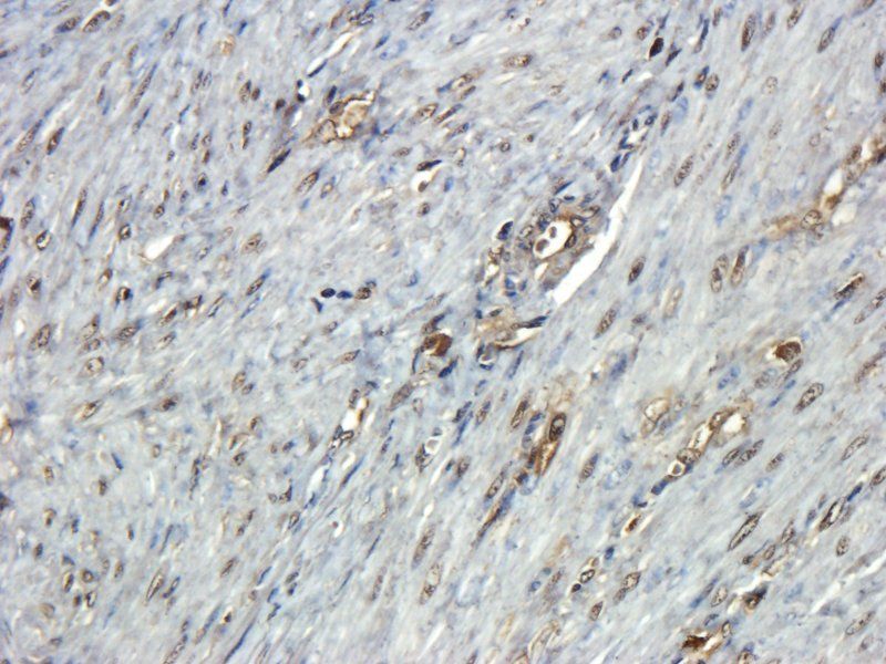 beta 1 Adrenergic Receptor Rabbit Polyclonal Antibody