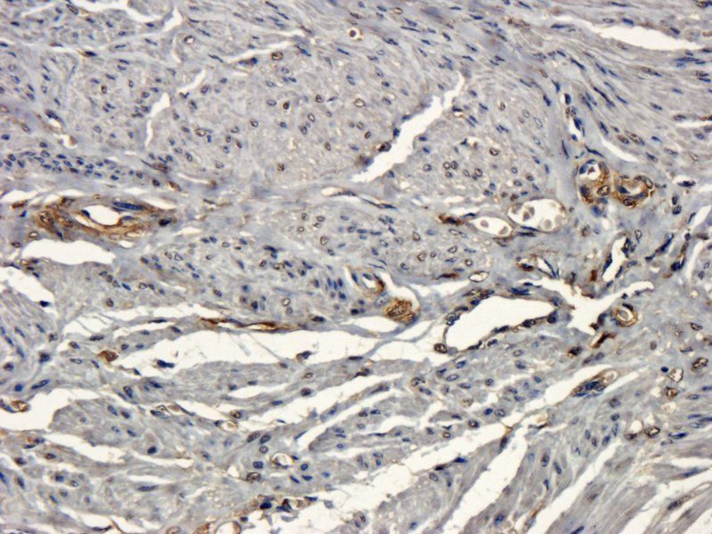 beta 1 Adrenergic Receptor Rabbit Polyclonal Antibody