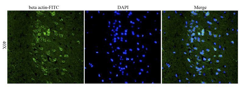 beta Actin Rabbit Polyclonal Antibody (FITC)