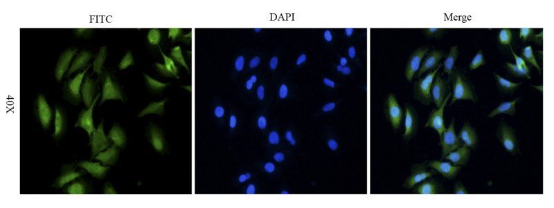beta Actin Rabbit Polyclonal Antibody (FITC)