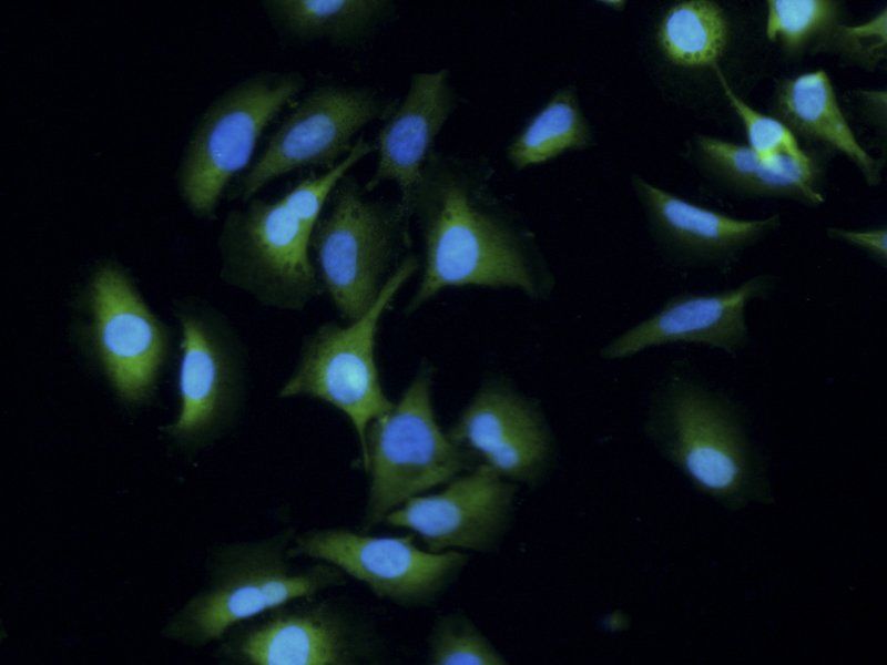 beta Actin Rabbit Polyclonal Antibody (FITC)