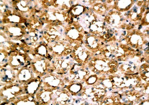 beta Actin Rabbit Polyclonal Antibody
