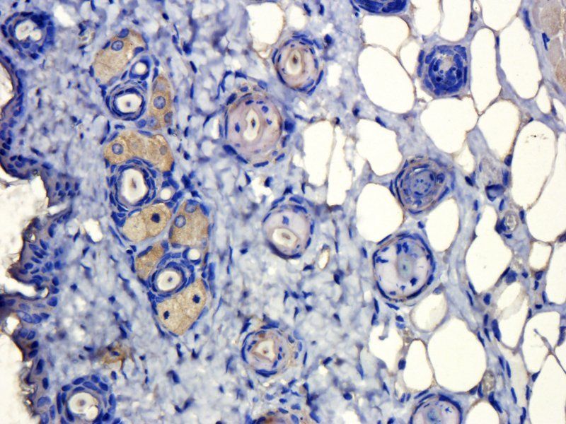 alpha MSH Rabbit Polyclonal Antibody