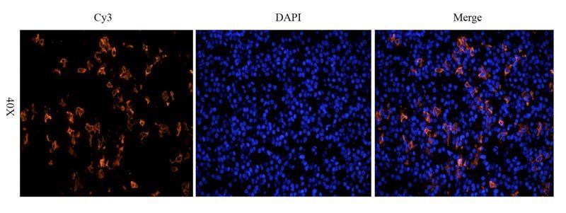 beta Endorphin Rabbit Polyclonal Antibody