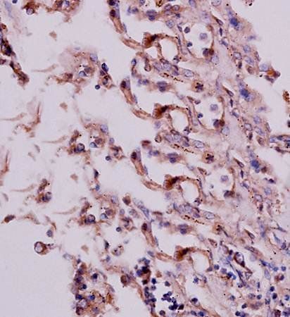 HCG beta Rabbit Polyclonal Antibody