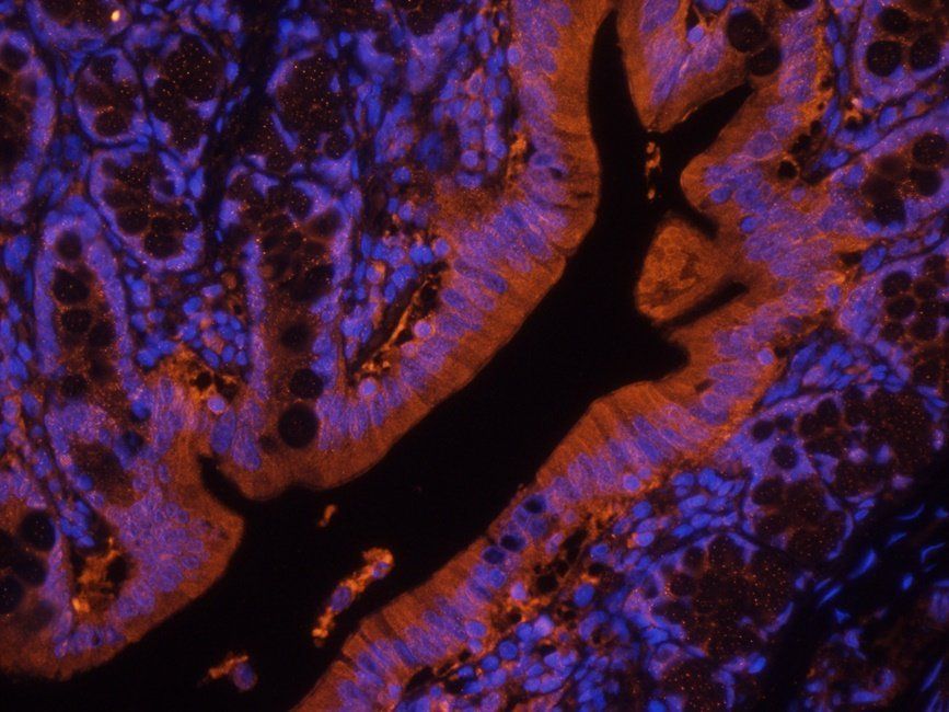 bFGF Rabbit Polyclonal Antibody