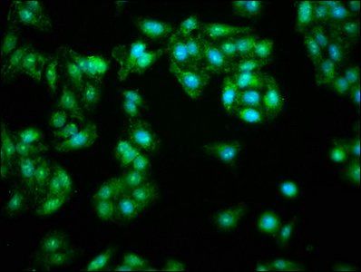FHIT Antibody
