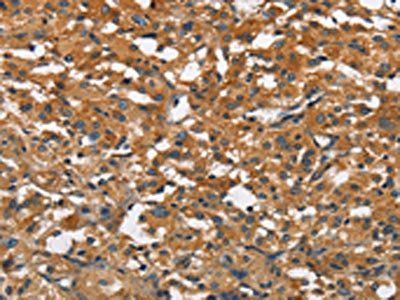 BLK Antibody