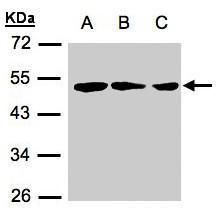 RARRES3 Rabbit Polyclonal Antibody