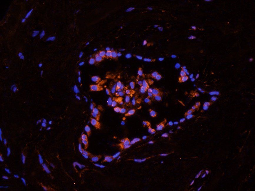 BMI1 Rabbit Polyclonal Antibody