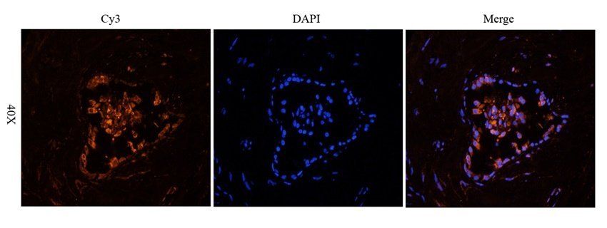 BMI1 Rabbit Polyclonal Antibody