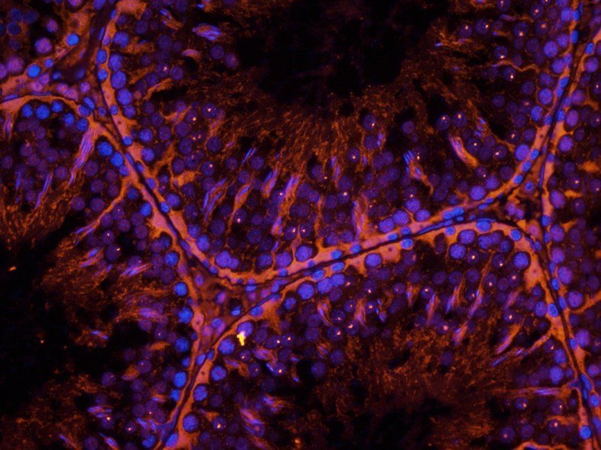 BMI1 Rabbit Polyclonal Antibody