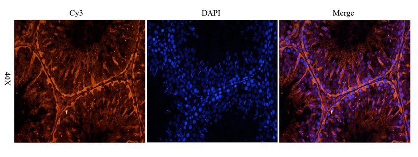 BMI1 Rabbit Polyclonal Antibody