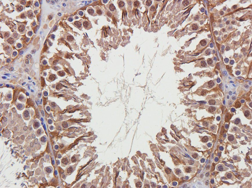 BMI1 Rabbit Polyclonal Antibody