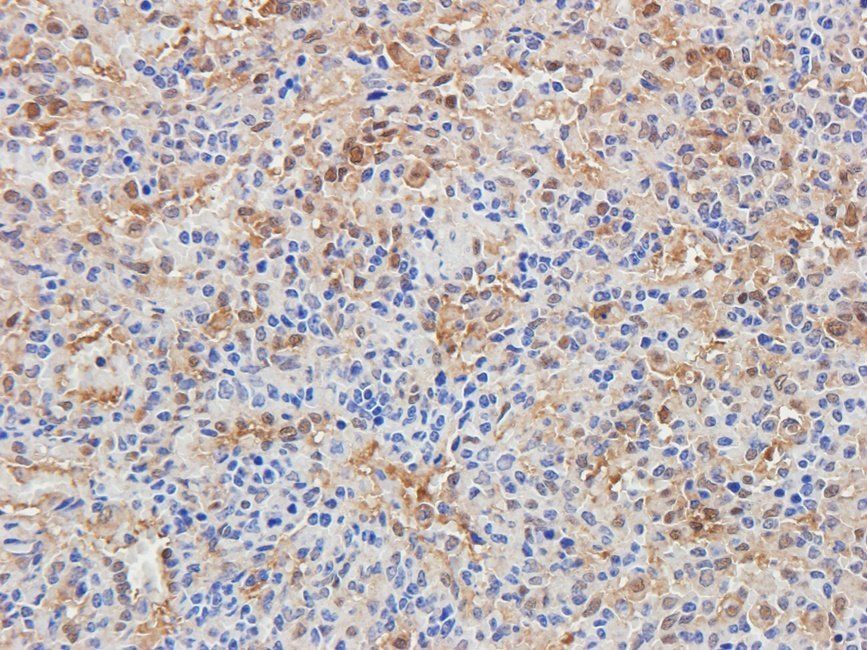 BMI1 Rabbit Polyclonal Antibody