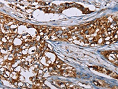 BMP6 Antibody