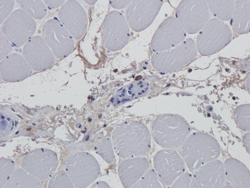 BMR1A Rabbit Polyclonal Antibody