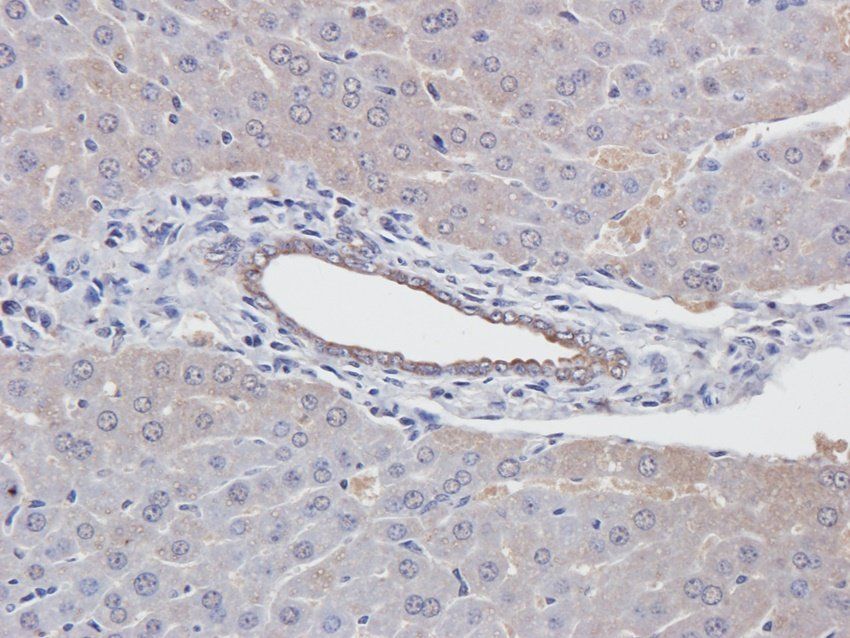 BMR1A Rabbit Polyclonal Antibody