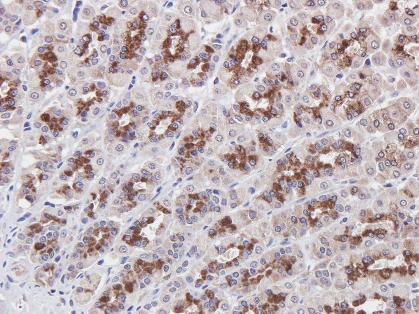 BMR1A Rabbit Polyclonal Antibody